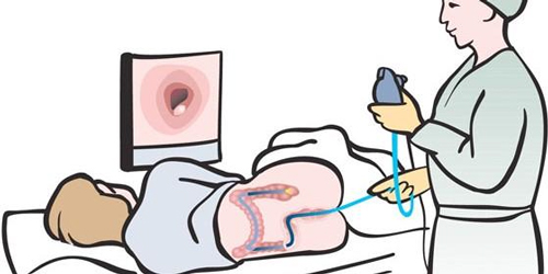Колоноскопия в Махачкале