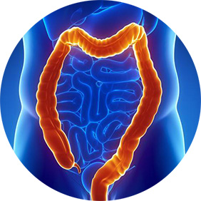 Свищ прямой кишки