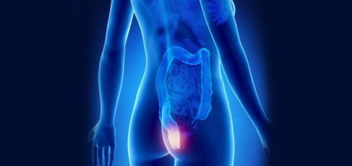 Решение деликатной проблемы: воспаление анального канала