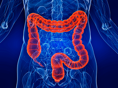 Коагуляция анальной папилломы